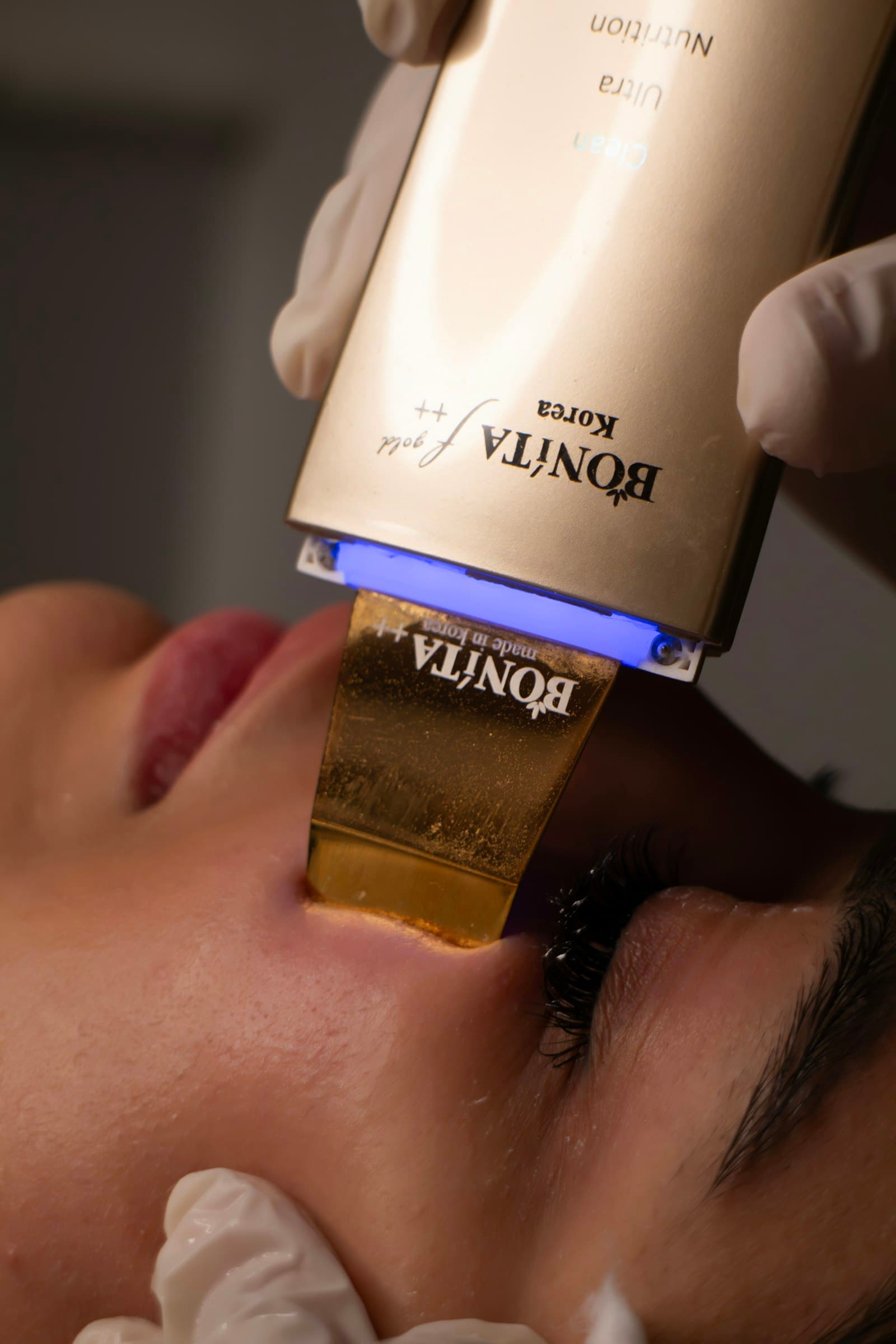 Microdermabrasion